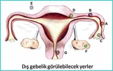 Dış Gebelik Testi Nasıl Yapılır? Dış Gebelik Testi Nasıl Yapılır?